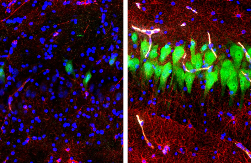 Active neurons (green) and cells (blue) in brains hooked up to the BrainEx system.